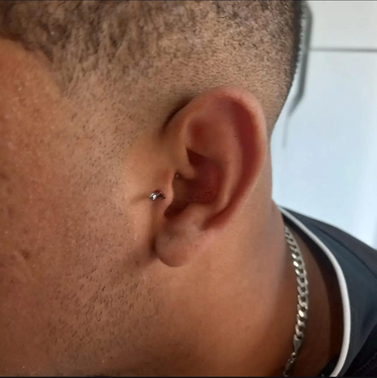 Tragus